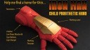 3D-Druck, Iron Man, Prothese, Hand, Pat Starace